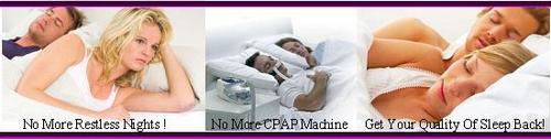 sleep Apnea Dental Appliance